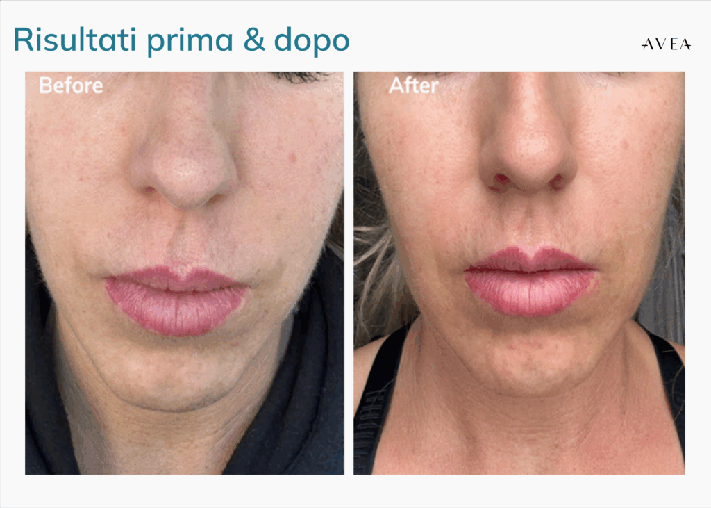 AVEA Collagen Activator esperienza